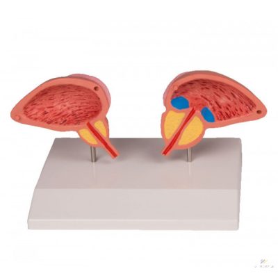 Prosztata modell, 2 részes