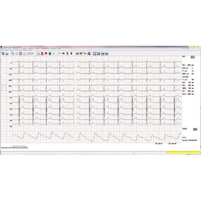 CARDIAX EKG terheléses modul