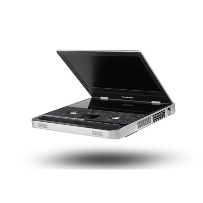 SonoScape E11 hordozható ultahang készülék