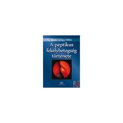 A PEPTIKUS FEKÉLYBETEGSÉG TÖRTÉNETE