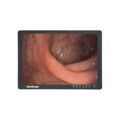 SonoScape 24" LCD orvosi színes monitor endoszkópiához, 1920 x 1200, IPS, 700 cd/m², Ref: 3900-00587/3900-0058