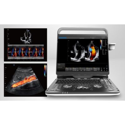 CHISON EBit 60 ultrahang rendszer