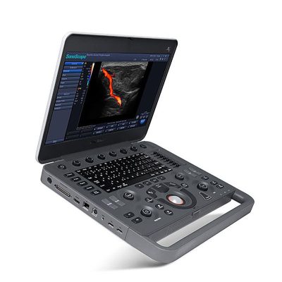 SonoScape X5 hordozható ultrahang készülék