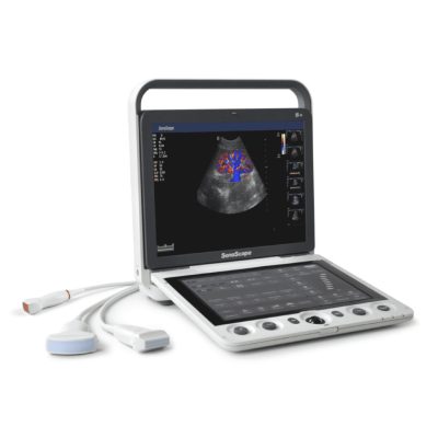 SonoScape S9 hordozható ultrahang készülék