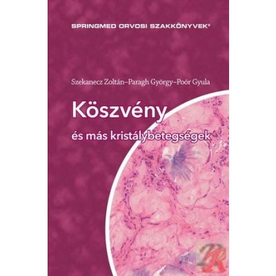 KÖSZVÉNY ÉS MÁS KRISTÁLYBETEGSÉGEK