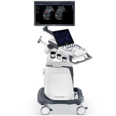 SonoScape P25 ultrahang készülék